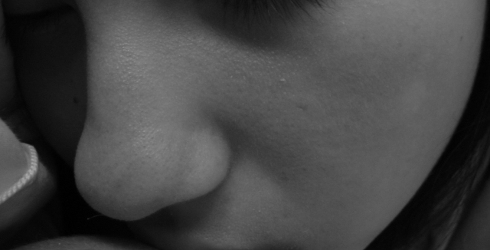 Tips Menghilangkan Komedo yang Membandel